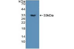 Detection of Recombinant PDPK1, Human using Polyclonal Antibody to Phosphoinositide Dependent Protein Kinase 1 (PDPK1)