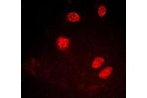 Immunofluorescence (IF) image for anti-X-Ray Repair Complementing Defective Repair in Chinese Hamster Cells 5 (Double-Strand-Break Rejoining) (XRCC5) (C-Term), (pThr714) antibody (ABIN7302726)