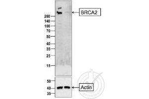 Image provided by the Independent Validation Program badge 29807. (BRCA2 Antikörper  (AA 21-130))