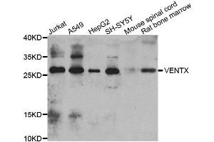 Western blot analysis of extracts of various cell lines, using VENTX antibody. (VENTX Antikörper)