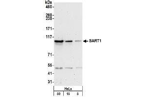 anti-Squamous Cell Carcinoma Antigen Recognized By T Cells (SART1) (AA 750-800) antibody