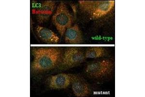 LC3 and the CLN3-encoded protein, battenin, co-immunostaining. (MAP1LC3A Antikörper  (N-Term))