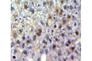 Used in DAB staining on fromalin fixed paraffin-embedded Liver tissue (CEBPG Antikörper  (AA 1-150))