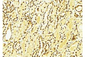 ABIN6274265 at 1/100 staining Mouse kidney tissue by IHC-P. (CK1 epsilon Antikörper  (Internal Region))