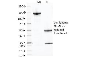 SDS-PAGE Analysis Purified CD71 Mouse Monoclonal Antibody (66IG10). (Transferrin Receptor Antikörper)