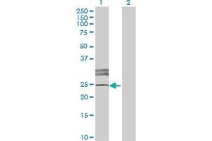 Western Blot analysis of LOC619207 expression in transfected 293T cell line by LOC619207 MaxPab polyclonal antibody. (SCART1 Antikörper  (AA 1-232))