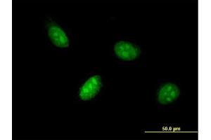 Immunofluorescence of monoclonal antibody to BHLHE41 on HeLa cell.