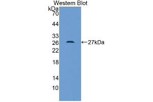 Detection of Recombinant AGER, Mouse using Polyclonal Antibody to Receptor For Advanced Glycation Endproducts (RAGE) (RAGE Antikörper  (AA 10-188))