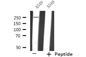 Western blot analysis of extracts from A549 cells, using PTPRZ1 antibody. (PTPRZ1 Antikörper  (N-Term))