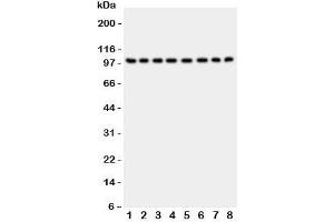 Western blot testing of CD10 antibody and Lane 1:  rat kidney;  2: (r) brain;  3: (r) liver;  4: human placenta;  5: (h) HeLa;  6: (h) Jurkat;  7: (h) Raji;  8: (h) 293T lysate;  Routinely visualized at ~100KD