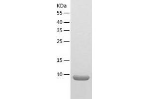 Western Blotting (WB) image for NADH Dehydrogenase (Ubiquinone) 1 alpha Subcomplex, 2, 8kDa (NDUFA2) (AA 1-99) protein (His tag) (ABIN7124102) (NDUFA2 Protein (AA 1-99) (His tag))