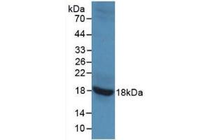 Detection of Recombinant GAD2, Rat using Monoclonal Antibody to Glutamate Decarboxylase 2 (GAD2) (GAD65 Antikörper)