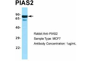 Host:  Rabbit  Target Name:  PIAS2  Sample Type:  MCF7  Antibody Dilution:  1.