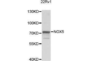 Western blot analysis of extracts of 22Rv1 cells, using NOX5 antibody. (NOX5 Antikörper  (AA 661-765))