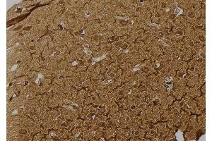 ABIN6266346 and ABIN6277205 at 1/100 staining Human brain tissue by IHC-P. (Histone 3 Antikörper  (H3K79me2))