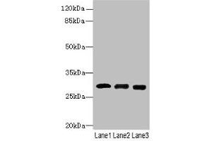 Western blot All lanes: CELA3A antibody at 14 μg/mL Lane 1: Mouse heart tissue Lane 2: Mouse skeletal muscle tissue Lane 3: Jurkat whole cell lysate Secondary Goat polyclonal to rabbit IgG at 1/10000 dilution Predicted band size: 30 kDa Observed band size: 30 kDa (Elastase 3A Antikörper  (AA 29-270))