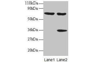 Western blot All lanes: SYNCRIP antibody at 2 μg/mL Lane 1: EC109 whole cell lysate Lane 2: 293T whole cell lysate Secondary Goat polyclonal to rabbit IgG at 1/15000 dilution Predicted band size: 70, 66, 63, 59, 47 kDa Observed band size: 70, 36 kDa (SYNCRIP Antikörper  (AA 2-191))