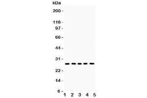 Western blot testing of ERAB antibody and Lane 1:  mouse lung; and human smaples  2: U87;  3: A549;  4: SW620;  5: 293T lysate. (HSD17B10 Antikörper  (AA 48-261))