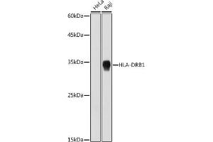 Western blot analysis of extracts of various cell lines, using HLA-DRB1 antibody (ABIN7268374) at 1:1000 dilution. (HLA-DRB1 Antikörper)