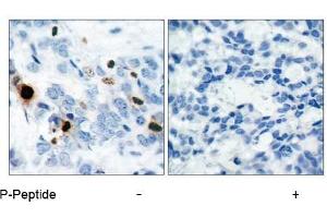 Image no. 1 for anti-Histone H3.1 (HIST1H3B) (pSer10) antibody (ABIN196922) (Histone H3.1 Antikörper  (pSer10))