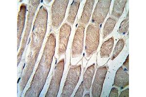 Immunohistochemistry (IHC) image for anti-Pyruvate Dehydrogenase Kinase, Isozyme 4 (PDK4) (AA 382-410) antibody (ABIN3028963)