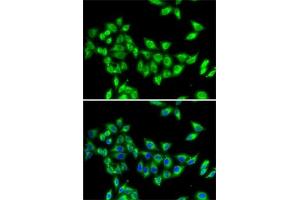 Immunofluorescence analysis of MCF7 cells using KIF3A antibody (ABIN6128170, ABIN6142871, ABIN6142872 and ABIN6222335). (KIF3A Antikörper  (AA 430-699))