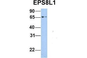 Host:  Rabbit  Target Name:  EPS8L1  Sample Type:  293T  Antibody Dilution:  1. (EPS8-Like 1 Antikörper  (Middle Region))