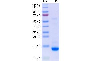 TGFB2 Protein (AA 303-414) (AVI tag,Biotin)