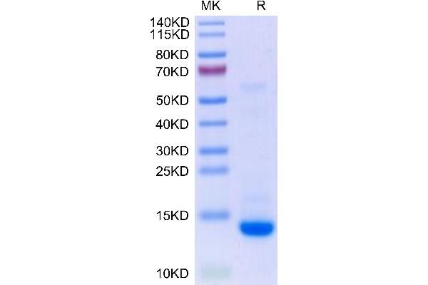 TGFB2 Protein (AA 303-414) (AVI tag,Biotin)