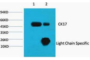 Immunoprecipitation (IP) analysis: 1) Input: HeLa Cell Lysate. (KRT17 Antikörper)