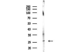 anti-Estrogen Receptor Binding Site Associated, Antigen, 9 (EBAG9) (C-Term) antibody