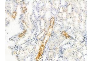 ABIN6255321 and ABIN6268974 at 1/100 staining human normal kidney tissue by IHC-P.