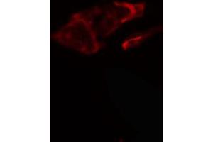 ABIN6266880 staining HeLa cells by IF/ICC. (COL5A1 Antikörper  (N-Term))