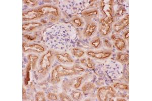 anti-ATP-Binding Cassette, Sub-Family B (MDR/TAP), Member 1 (ABCB1) (AA 621-650), (Middle Region) antibody