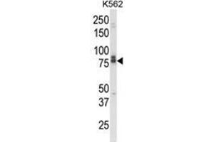 Western blot analysis of IL18RAP Antibody (N-term) in K562 cell line lysates (35ug/lane). (IL18RAP Antikörper  (N-Term))