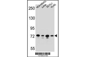 Western blot analysis in MDA-MB453,Jurkat,ZR-75-1,HL-60 cell line lysates (35ug/lane). (PCDHB15 Antikörper  (N-Term))