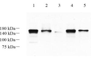 Western blot analysis of LRIG1 (ABIN7074488),at dilution of 1: 1000,Lane 1: Mouse brain tissue lysate,Lane 2: Mouse cerebellum tissue lysate,Lane 3: Mouse skin tissue lysate,Lane 4: Rat brain tissue lysate,Lane 5: Rat cerebellum tissue lysate (Lrig1 Antikörper)