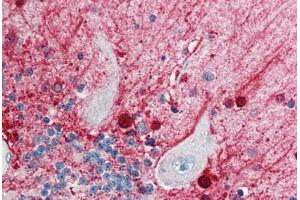 Human Brain, Cerebellum (formalin-fixed, paraffin-embedded) stained with CASP5 antibody ABIN214433 at 5 ug/ml followed by biotinylated goat anti-rabbit IgG secondary antibody ABIN481713, alkaline phosphatase-streptavidin and chromogen. (CASP5 Antikörper)