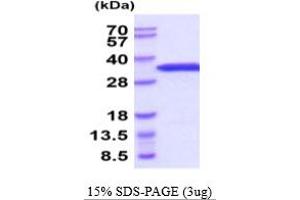 SDS-PAGE (SDS) image for Eukaryotic Translation Initiation Factor 4E (EIF4E) (AA 1-217) protein (His tag) (ABIN6387994) (EIF4E Protein (AA 1-217) (His tag))