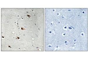 Immunohistochemical analysis of paraffin-embedded human brain tissue using E2A (Phospho-Thr355) antibody (left)or the same antibody preincubated with blocking peptide (right). (TCF3 Antikörper  (pThr355))