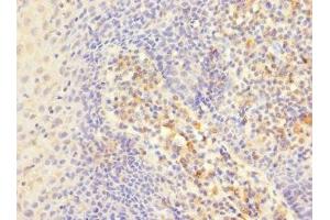 Immunohistochemistry of paraffin-embedded human tonsil tissue using ABIN7156455 at dilution of 1:100 (CD103 Antikörper  (AA 19-200))