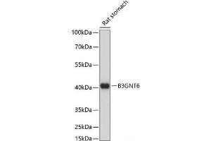 Western blot analysis of extracts of Rat stomach using B3GNT6 Polyclonal Antibody at dilution of 1:1000. (B3GNT6 Antikörper)