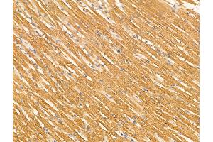 ABIN7094547 and ABIN7098596 at 1/100 staining Rat heart tissue by IHC-P.