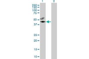 Western Blot analysis of CREB3L4 expression in transfected 293T cell line by CREB3L4 MaxPab polyclonal antibody. (CREB3L4 Antikörper  (AA 1-395))