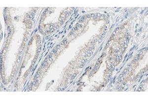 ABIN6269292 at 1/100 staining Human prostate tissue by IHC-P.
