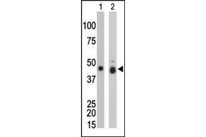 The anti-CKB Pab (ABIN391073 and ABIN2841220) is used in Western blot to detect CKB in mouse colon tissue lysate (Lane 1) and Y79 cell lysate (Lane 2).
