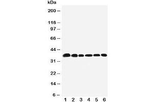 Western blot testing of Nucleophosmin antibody and Lane 1:  rat testis;  2: (r) brain;  3: human HeLa;  4: (h) U87;  5: (h)A549;  6: (h) SMMC-7721 cell lysate. (NPM1 Antikörper  (N-Term))