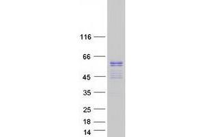 Validation with Western Blot