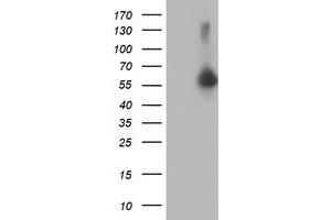 Western Blotting (WB) image for anti-V-Akt Murine Thymoma Viral Oncogene Homolog 1 (AKT1) antibody (ABIN1496559) (AKT1 Antikörper)