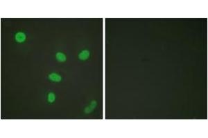 Immunofluorescence analysis of HeLa cells, using Histone H3 (Acetyl-Lys27) Antibody. (Histone 3 Antikörper  (H3K27ac))